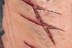 tear